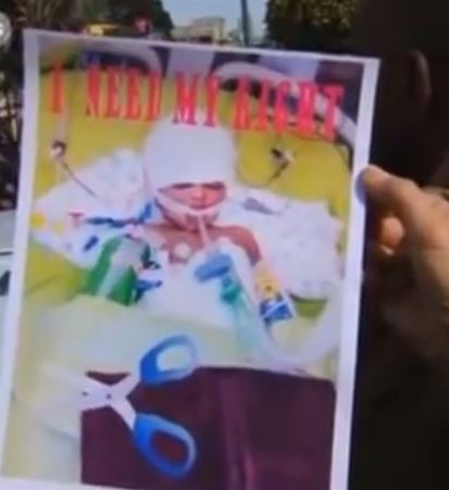 Διαδηλωτές κρατούν αφίσα με το παιδί και τα ψαλίδια