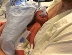 μωρό-νεογέννητο-από-εγκεφαλικά-νεκρή-μητέρα-blog-του-dylan-benson