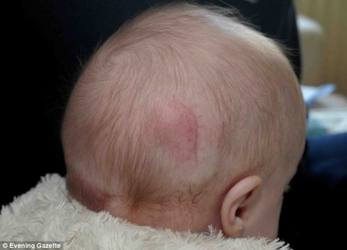 Η Faith μετά την επέμβαση αφαίρεσης 