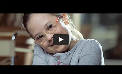 σύνδρομο down