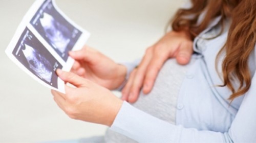 Το παιδί του Άγιου Σάββα, το μικρό μου θαυματάκι