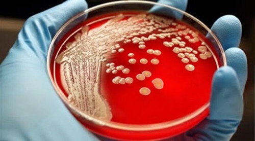 παγκόσμια-απειλή-τα-σούπερ-μικρόβια-βγάζουν-άχρηστα-τα-αντιβιοτικά