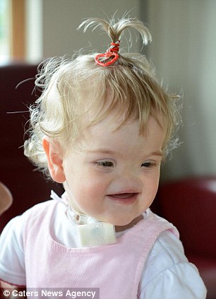 απίστευτο-κοριτσάκι-γεννήθηκε-χωρίς-μύτη-3