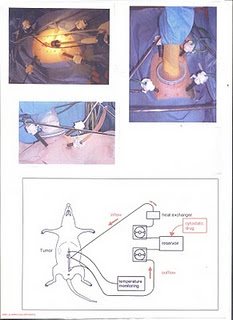 λάστιχα-υπερθερμικής-χημειοθεραπείας