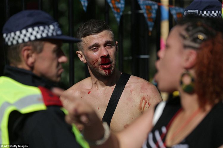 One man with a bloodied face appeared to look dazed as he spoke to police officers on the second day of the famous carnival
