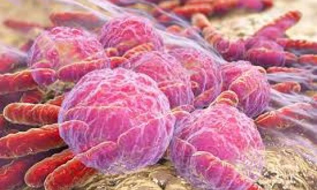 Chlamydia trachomatis