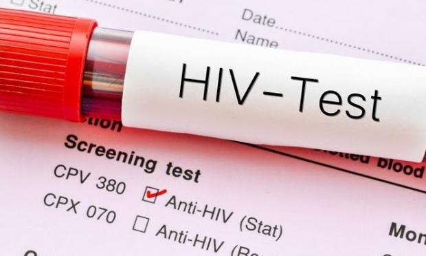 HIV AIDS