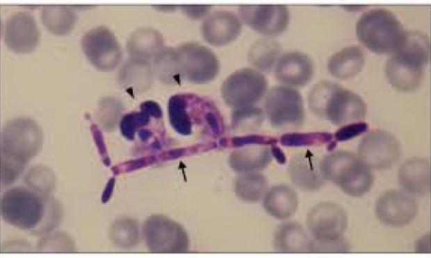 Candida parapsilosis
