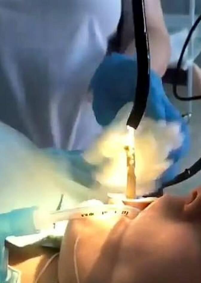 φίδι στο λαιμό