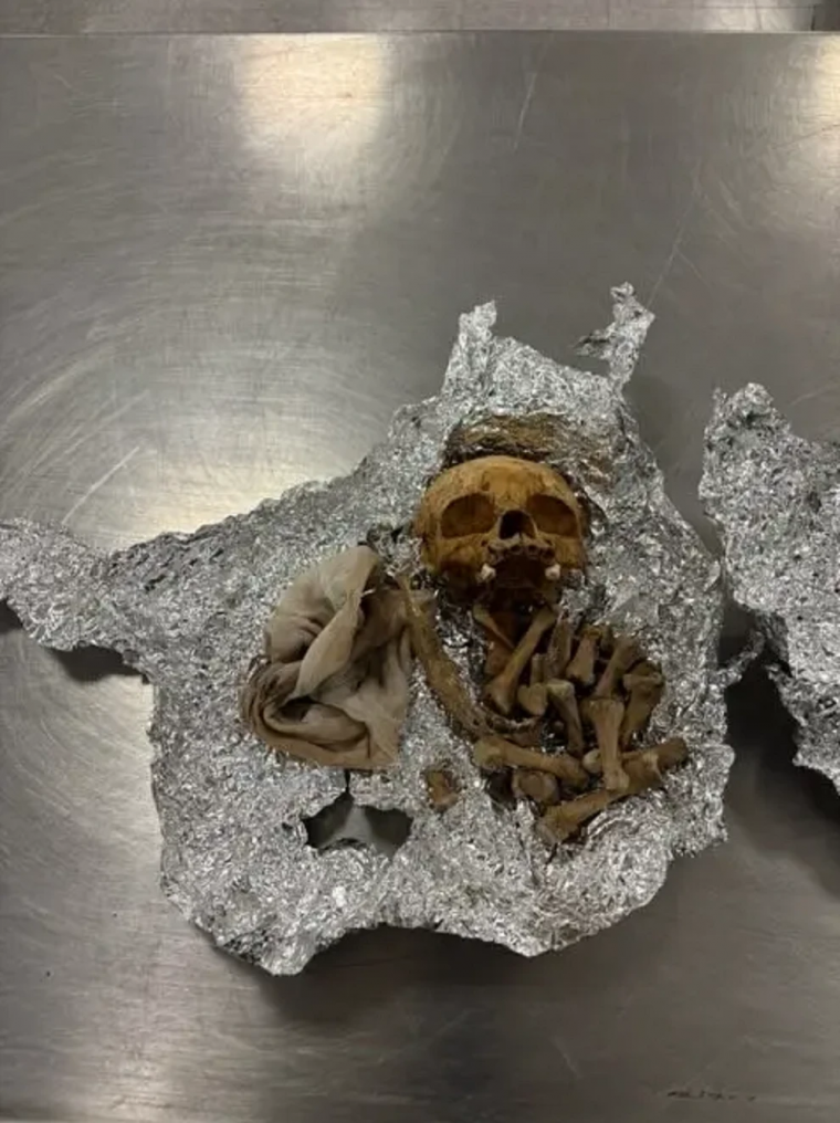 skeletos