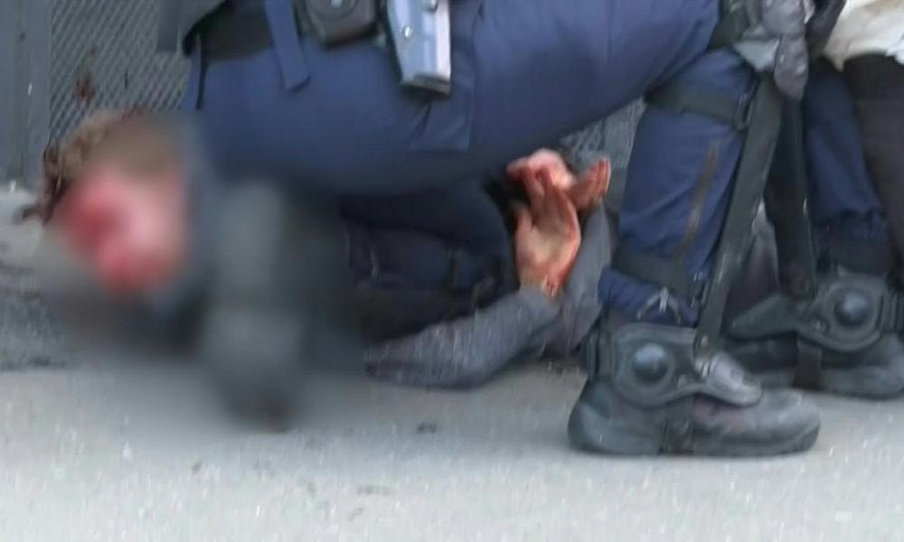 κίτρινα γιλέκα, Γαλλία, αστυνομική βία