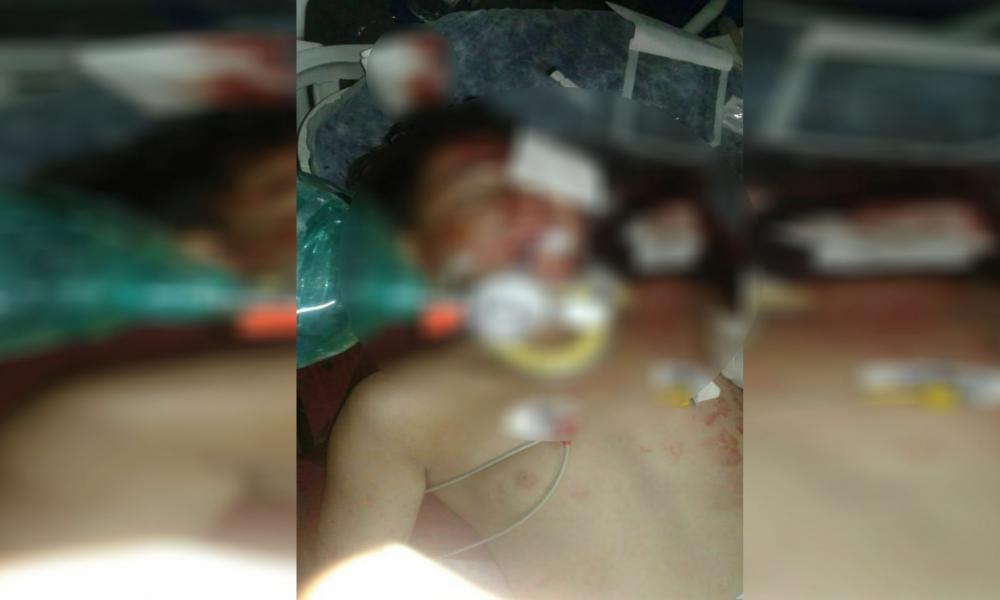Αφρίν: Τούρκοι χτύπησαν με θωρακισμένο όχημα και εγκατέλειψαν δύο παιδιά | Pentapostagma