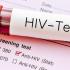 HIV AIDS