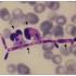 Candida parapsilosis