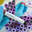 H1N1 κορωνοιος