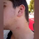 Κυρμπάτσης