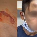 Ξυλοδαρμός 17χρονου στο Γαλάτσι