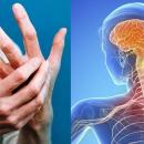 Σκλήρυνση κατά πλάκας