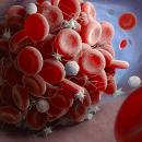 Θρομβοεμβολή