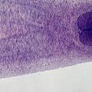 συκώτι παρασιτα