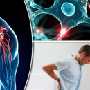 σκλήρυνση κατα πλάκας