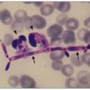 Candida parapsilosis