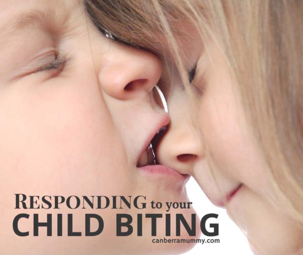 Image result for kids biting